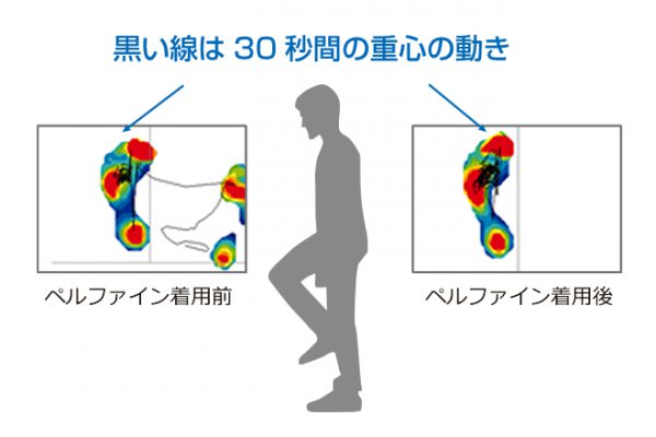 「ペルファイン」使用の実証検査その1